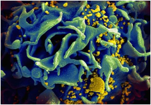 日逼很爽开发出靶向HIV病毒库的Dual-CAR-T细胞,为治愈HIV感染奠定基础